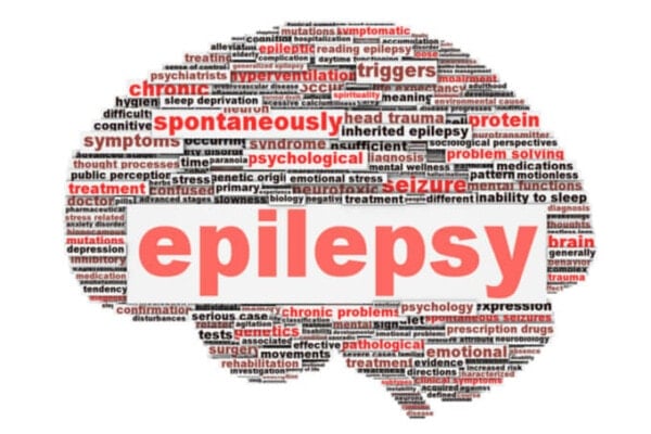 Top 5 Alternative Treatments for Epilepsy