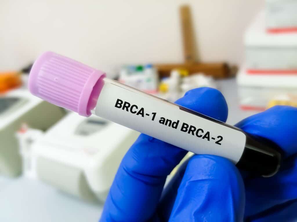 BRCA-1 and BRCA-2 Test Tube